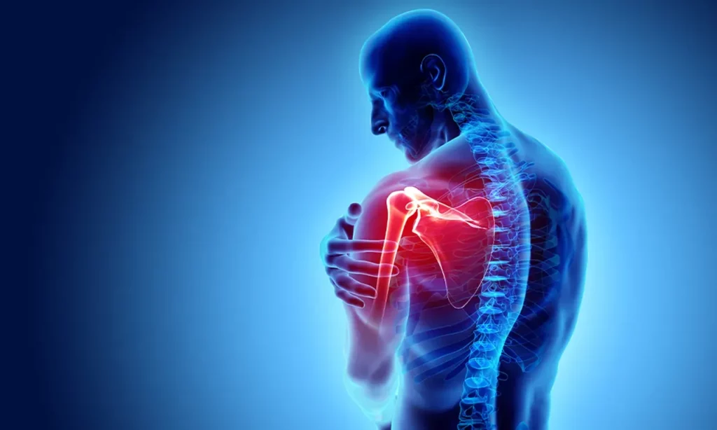 2448968 Shoulder Reconstruction Princeton NJ