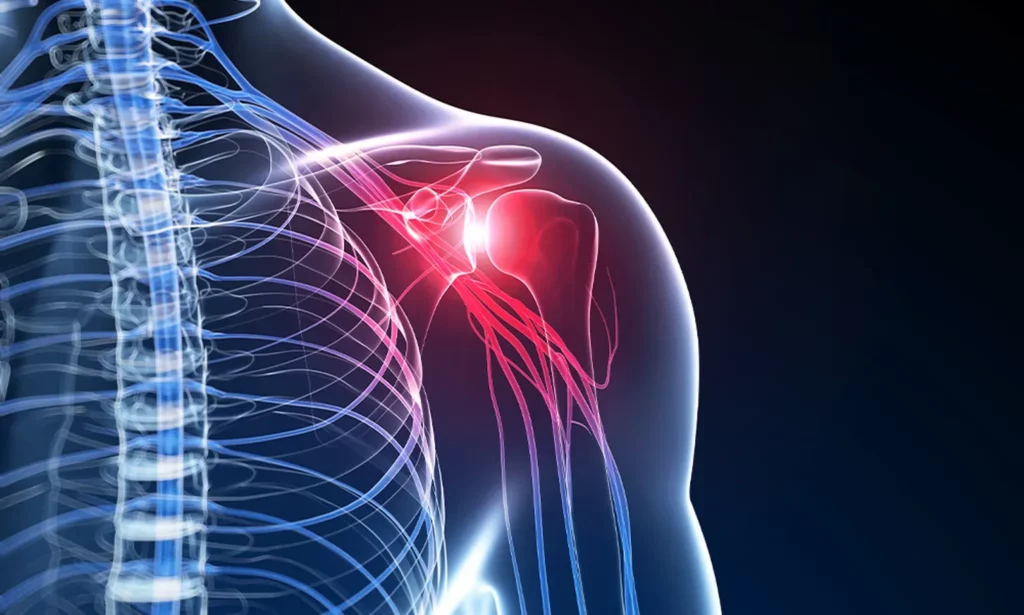 Labral Tear in Princeton NJ