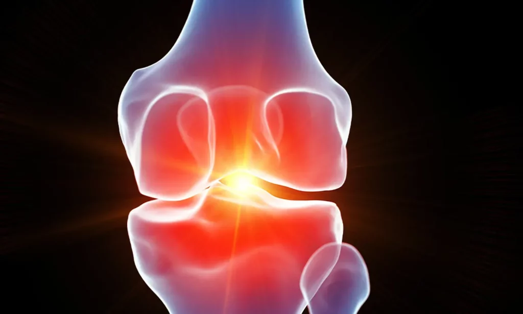 Meniscus & Cartilage Repair Princeton NJ Meniscus & Cartilage Repair Princeton NJ