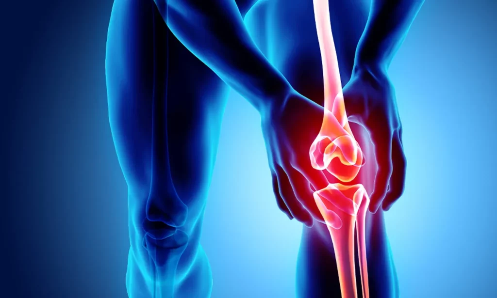 Knee Arthritis Princeton NJ Knee Arthritis Princeton NJ
