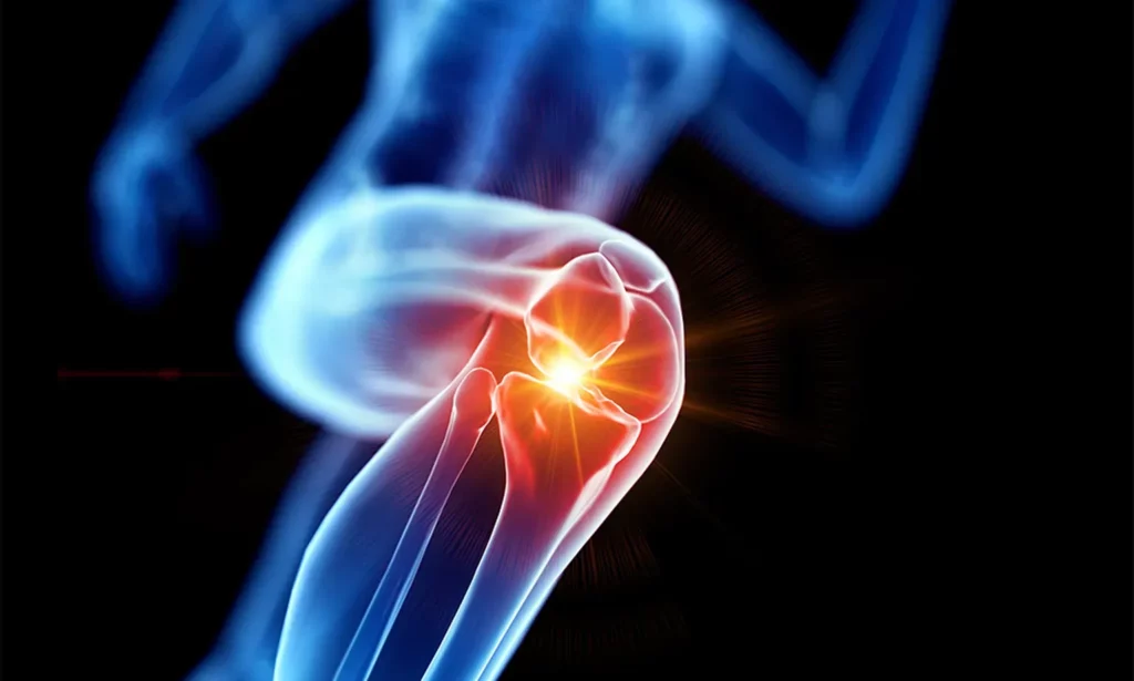 Knee Replacement Princeton NJ