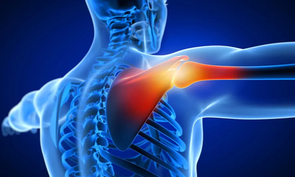 Shoulder Replacement Princeton NJ Shoulder Replacement Princeton NJ